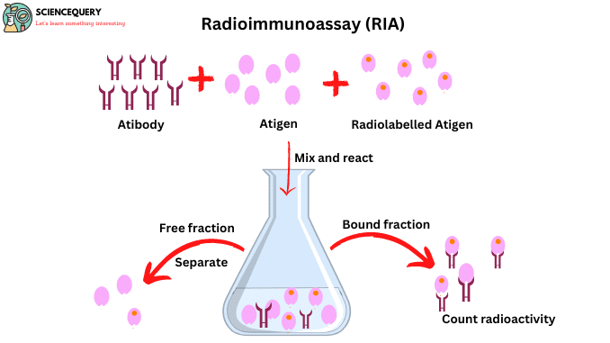 Radioimmunoassay