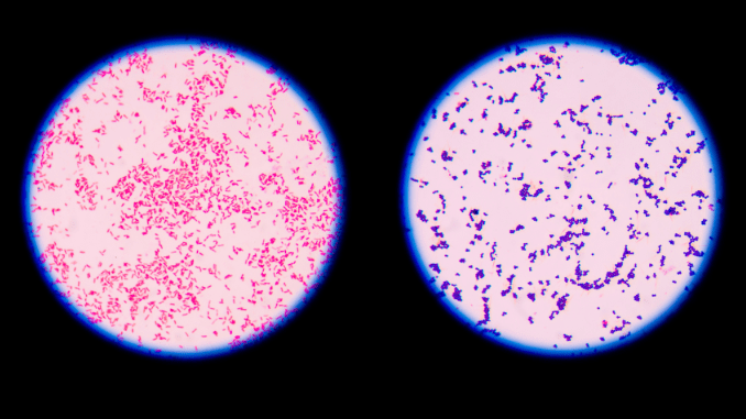 gram staining bacillus subtilis
